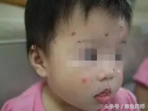 当心传染病暴发,注意到了冬季传染病高发期