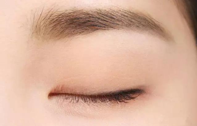 美瞳边缘碎在眼睛里面了,为什么美瞳会在眼睛里碎掉