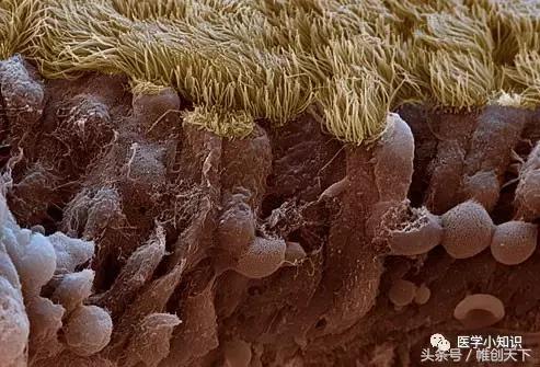 鼻窦炎引起头痛怎么治疗,鼻窦炎的症状及食疗视频播放