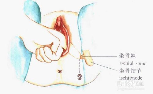 顺产侧切要多长时间伤口能彻底好,顺产侧切有哪些事项要注意