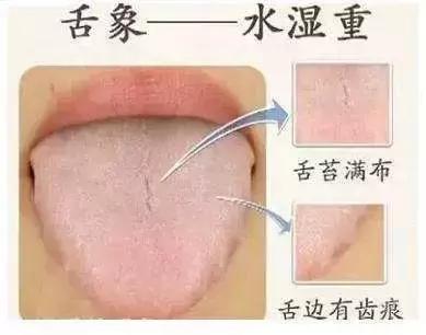 一碗汤调养脾胃很实用,一碗汤改善脾虚气虚湿气重