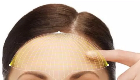 自体脂肪可以填额头吗,广东自体脂肪丰额头