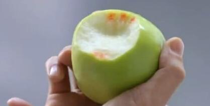 智齿引起牙龈出血怎么办,智齿挤压其它牙齿致牙龈出血咋办