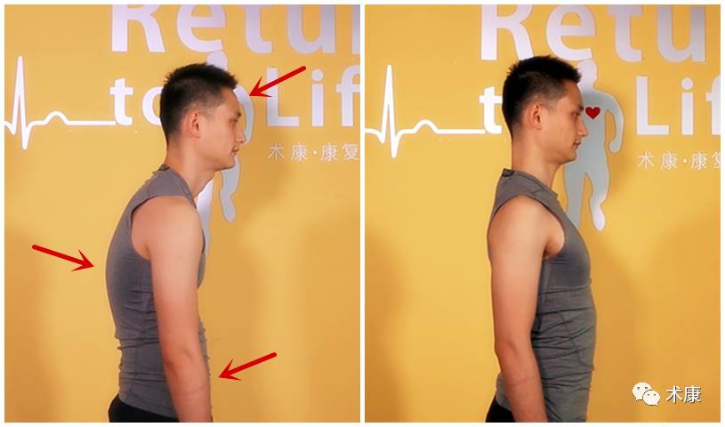 治疗颈椎病，每天只要3分钟