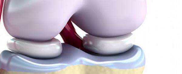 膝盖垫片磨损疼吃什么药缓解,膝盖痛可能是什么问题