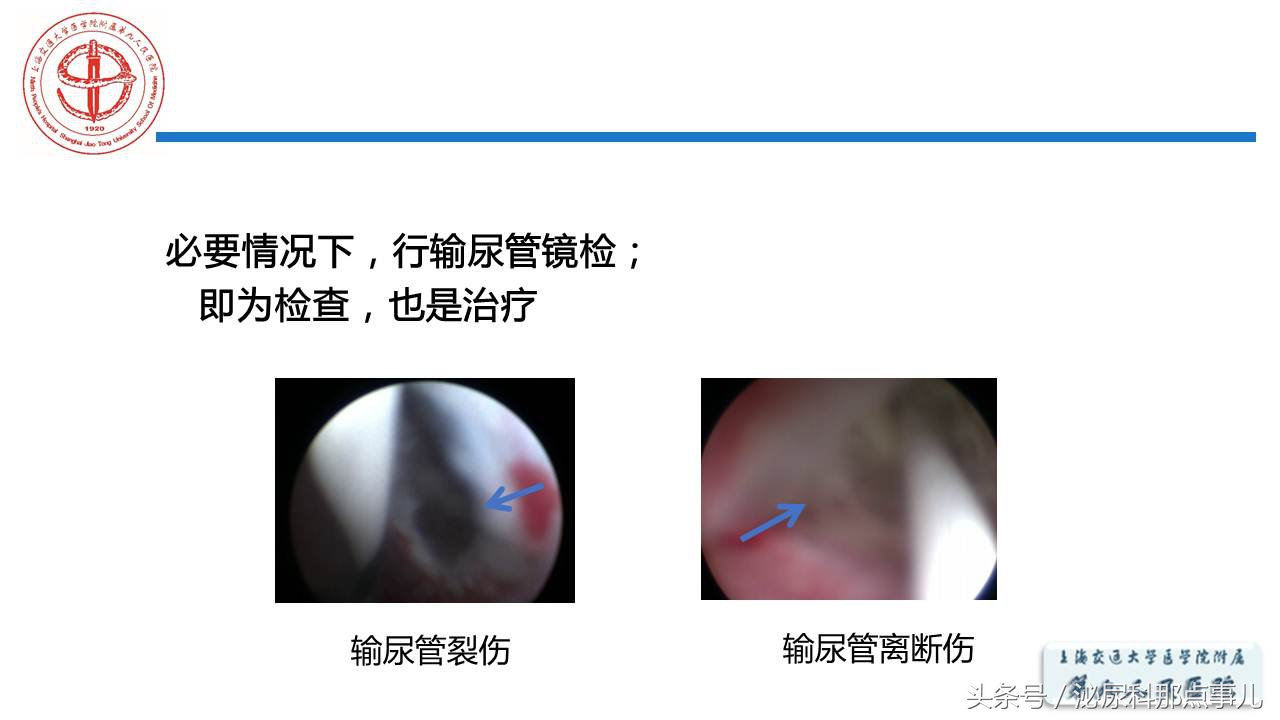 泌尿男科王忠教授,泌尿外科专家王忠教授