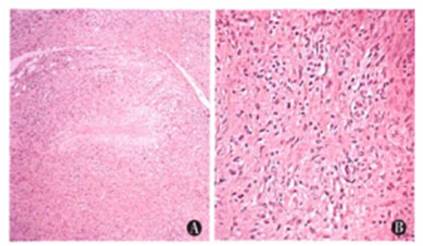 小儿四肢出现瘙痒性皮疹,儿童四肢有小疙瘩有点痒反反复复