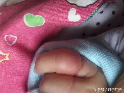 妈妈的头发，竟成宝宝“缠绕伤”的罪魁祸首！