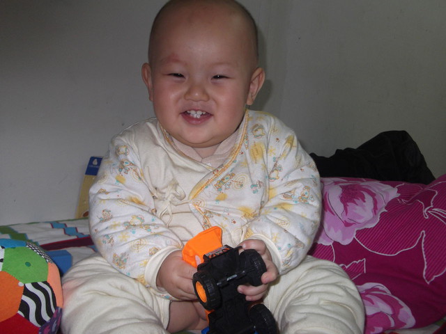 六个月宝宝出水痘发烧了怎么办,六个月宝宝感染水痘