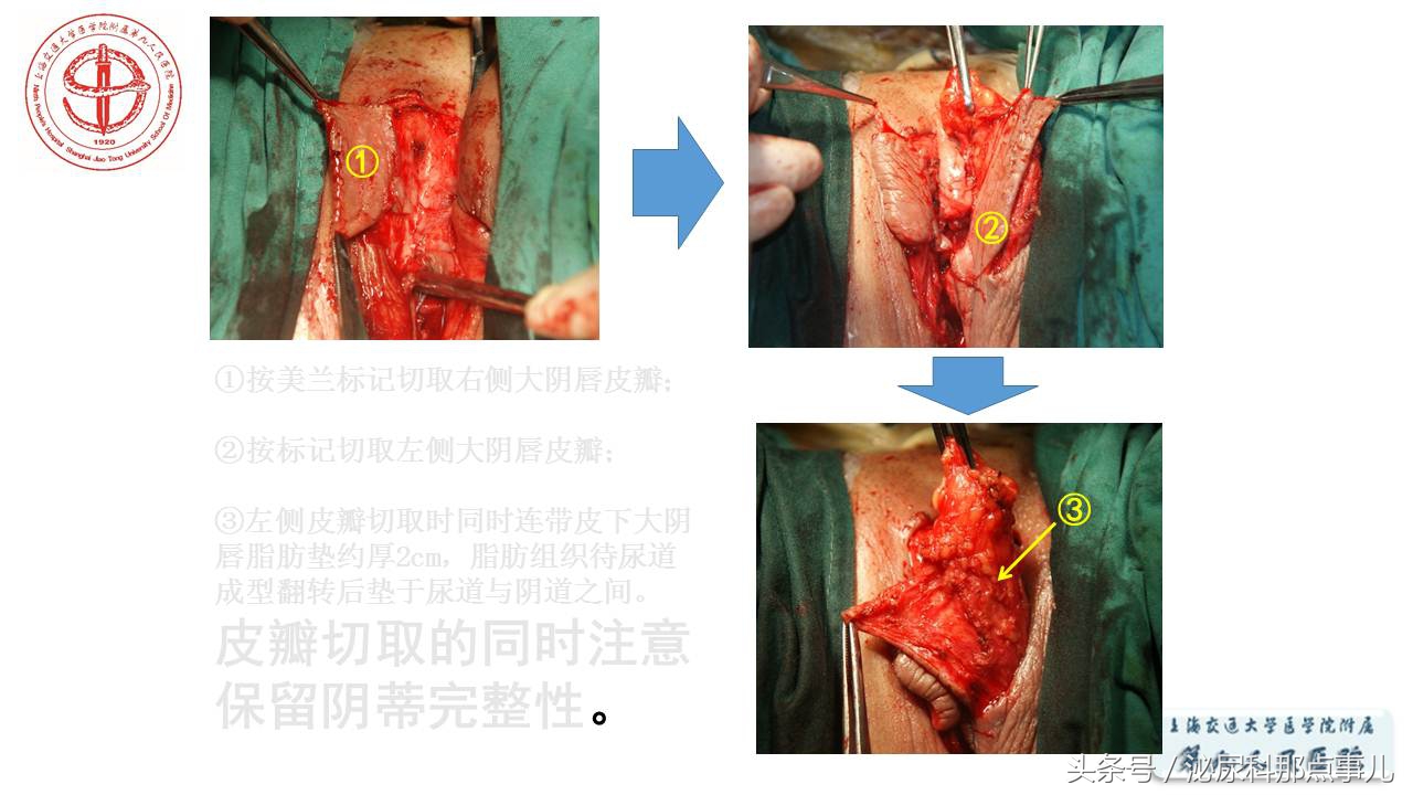 泌尿男科王忠教授,泌尿外科专家王忠教授