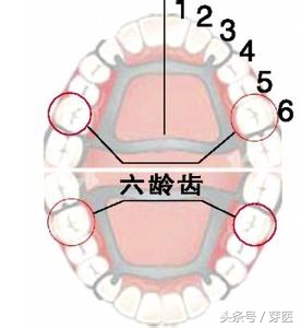 刚换牙的宝宝门牙长歪怎么办,宝宝门牙为什么长的象锯齿状