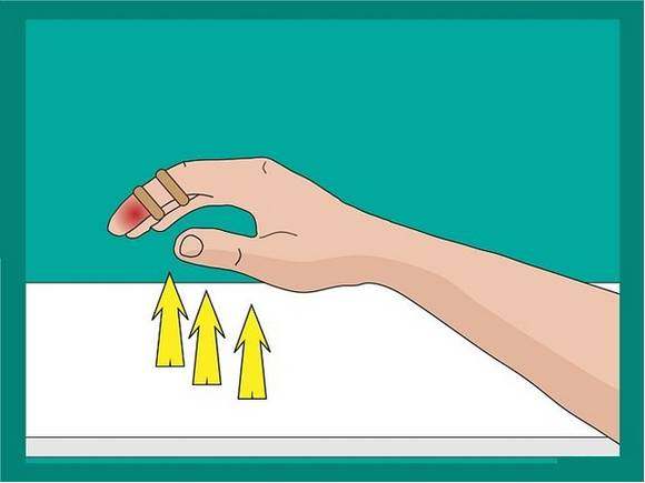 连这种痛都没经历过，都不好意思说你打过球！高手的必修绝技！