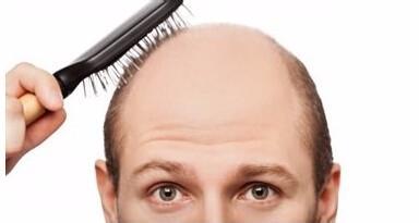 为什么现在的人脱发掉发严重,为什么年轻人老是掉头发