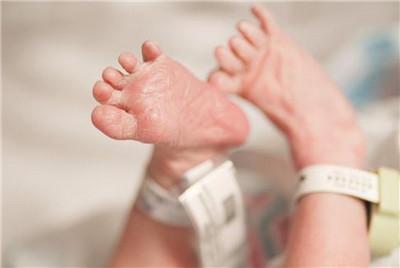 胎儿肠管扩张最坏结果,胎儿结肠肠管扩张不做羊穿