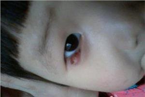 宝宝长倒睫毛,宝妈别再瞎剪了,这样做不对的