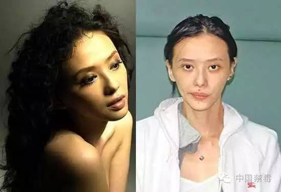 那些吸毒而毁容的明星,明星吸毒后和吸毒前的照片对比