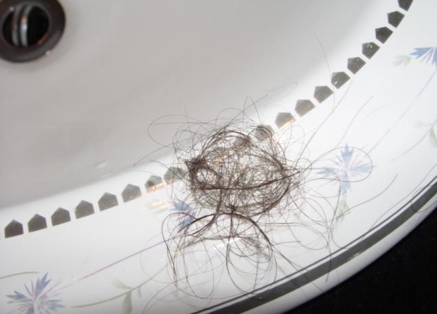 为什么最近老是掉头发呢?|年轻人脱发的七大原因