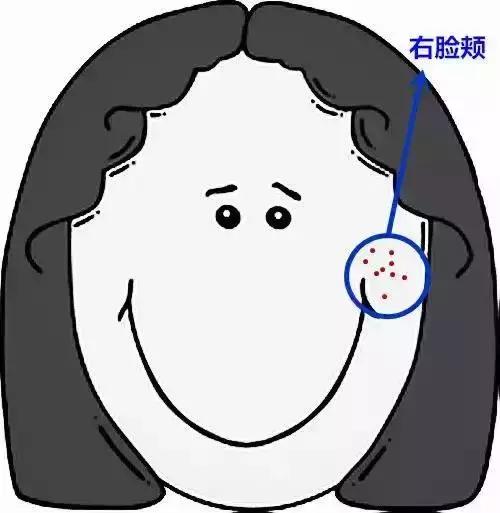 脸上长个痘痘挤出来白色的臭臭的,胳膊上有痘痘挤出来是白色条状物