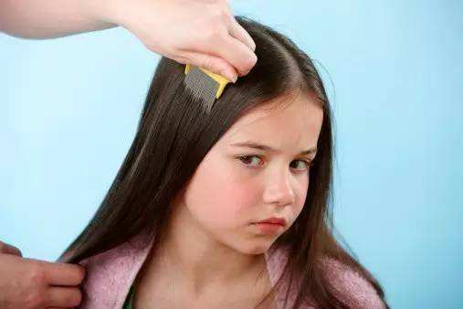 断发头皮护理护发素,修复头发最好的护发产品