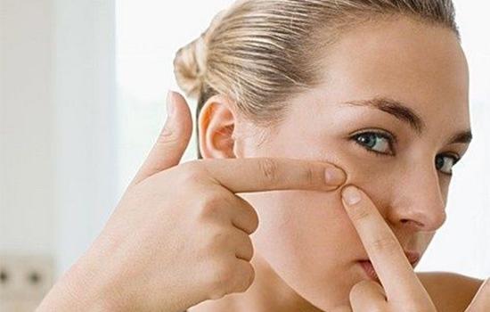 粉刺怎么彻底去除小妙招,粉刺怎么彻底去除
