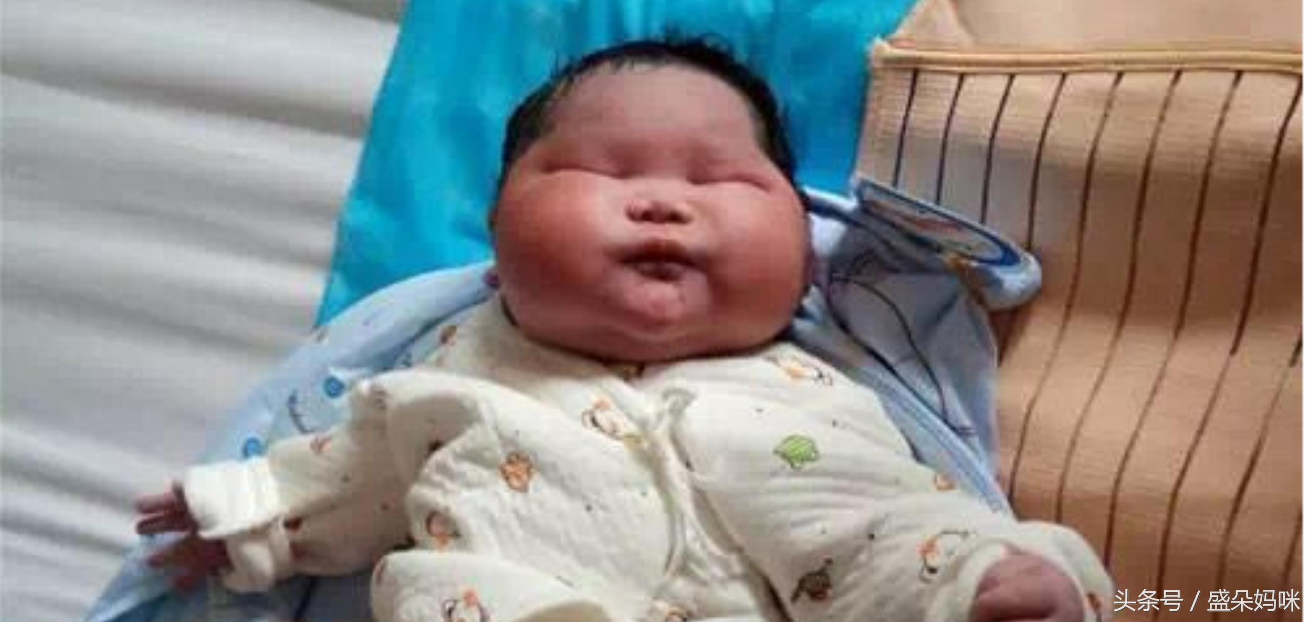 13.4斤重量级宝宝面世,但这不是好榜样!