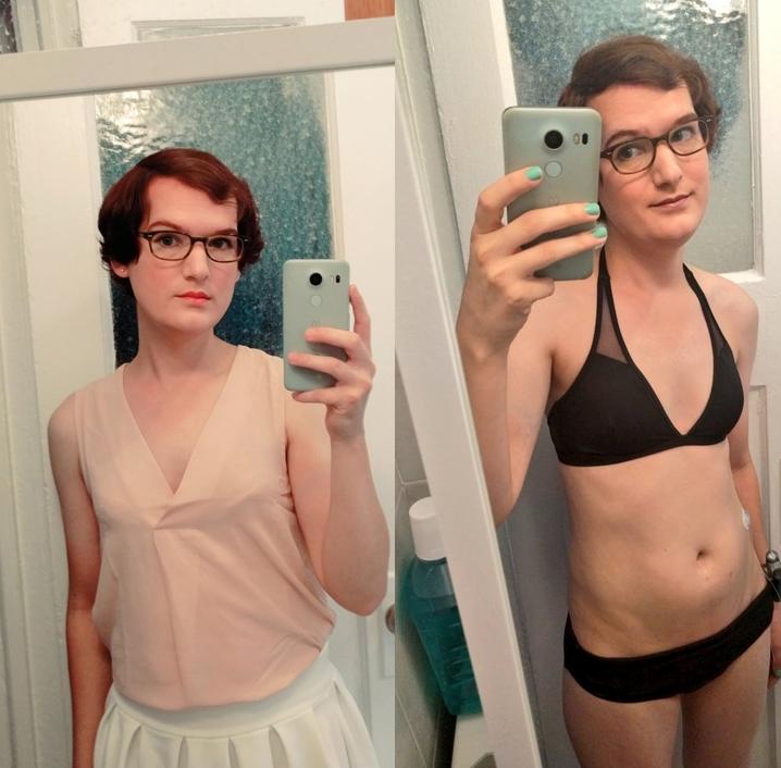 厉害了word的雌性激素，竟然还能拯救大叔的秃顶