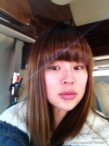 车晓鼻子现在好了吗,车晓整鼻子了吗