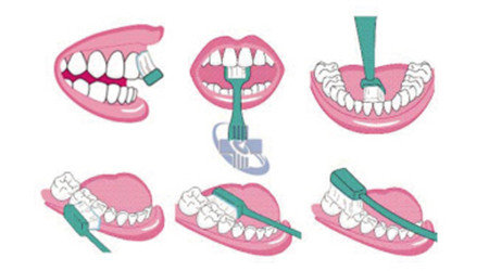 牙齿黄好像里面都黄怎么美白,牙齿黄怎么美白最快用盐