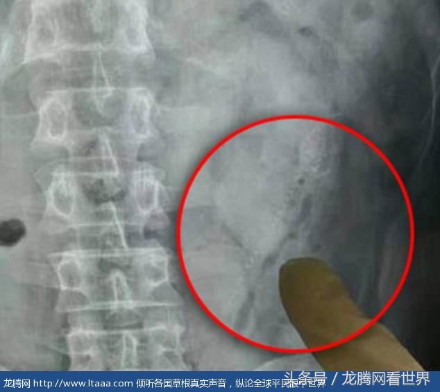 醉酒男子将两条活鱼塞进菊花