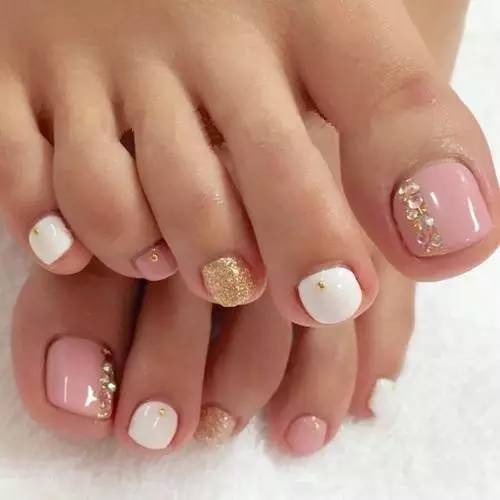 喜欢美甲的女孩要注意一种疾病：嵌甲