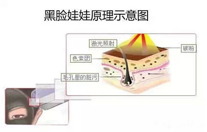 黑脸娃娃几天会白,黑脸娃娃皮肤变暗