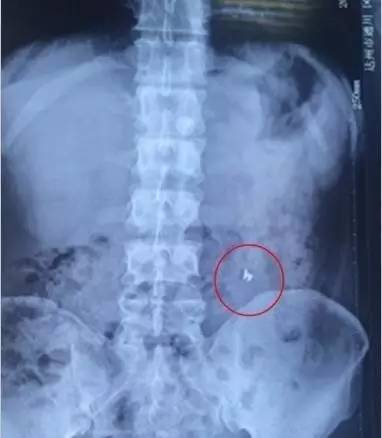 今年的315事件带来的反思,315事件带给我们的反思