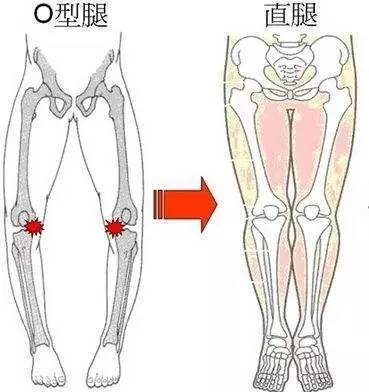 小腿结构图示图片,小腿骨骼构造示意图