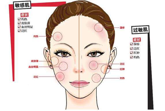 宝宝对牛奶过敏怎么改善体质,怎么改善易过敏体质