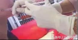 想瘦脸应该做什么项目,跳绳瘦脸效果最好的方法