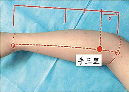 灸哥论穴:用艾灸疗法调理网球肘