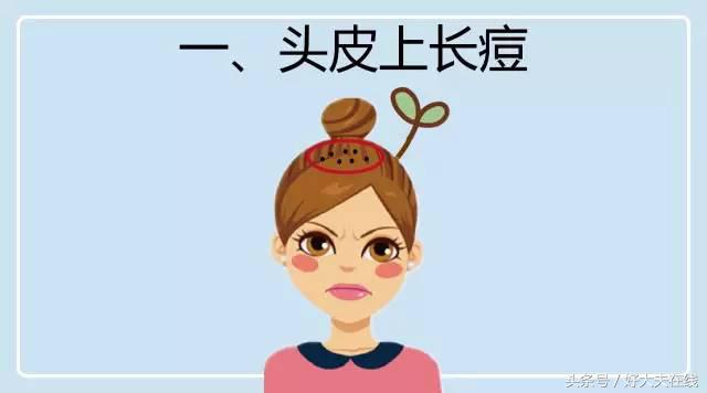 鼻梁旁边有痘是哪个内脏反应区,背部和下巴长痘是不是内脏有问题