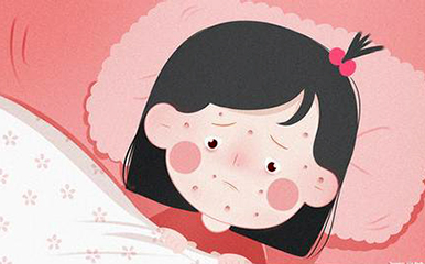 水痘患儿要隔离至全部结痂才可免除