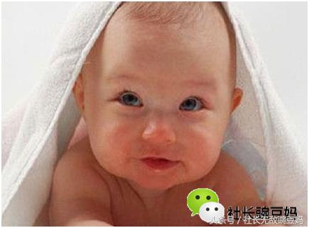 婴儿脸上起小红点还痒怎么回事,婴儿脸上起红点用不用去医院