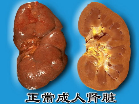 慢性肾衰健康指导,肾切除术后康复指导