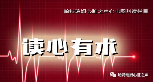 读心有术视频讲解,长期心电图提示下壁st段轻度压低