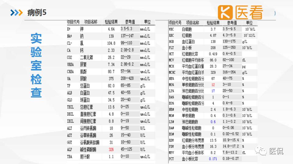 精原细胞瘤ct影像,精原细胞瘤影像特征