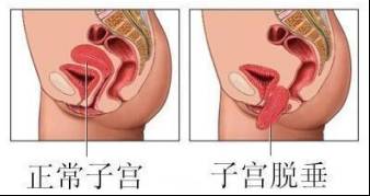 「福利」生完孩子千万别忘了这件事！盆底功能免费筛查，你预约了吗？关注盆底健康，做幸福女人！