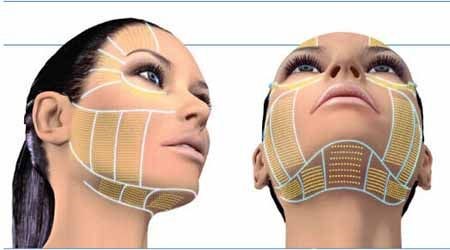 超声刀美容有什么副作用吗,私密超声刀的功效作用