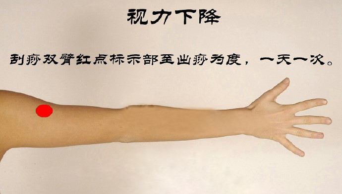 儿童改善近视的穴位动图,治疗儿童近视眼穴位按摩仪器