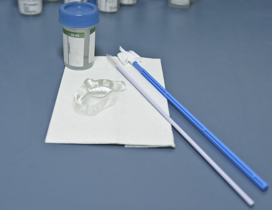 宫颈高度病变镜下观察,宫颈镜下可疑浸润癌严重吗