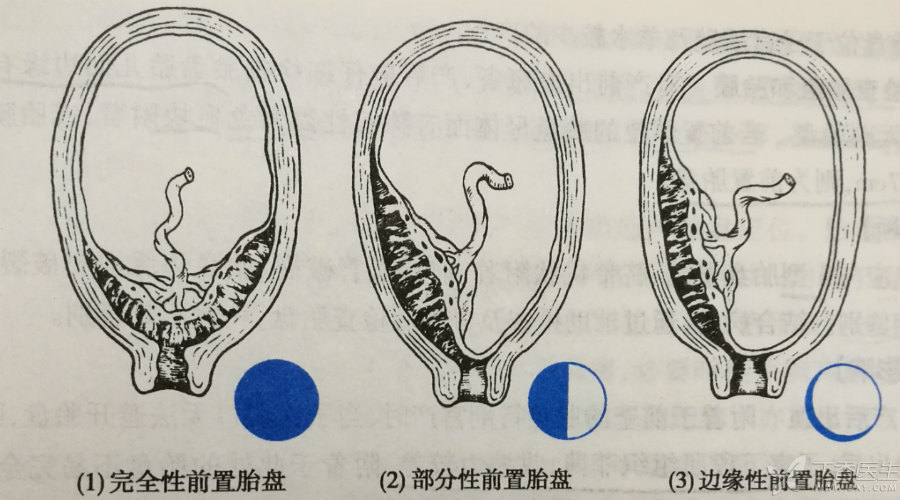 前三个月为啥出血两次,经前肚子疼阴道出血的症状有哪些