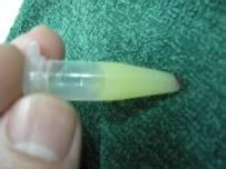 受伤后流出无色液体,受伤后伤口流出的透明液体是什么