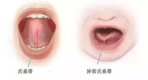 小朋友吐字不清楚怎么办,小朋友说话口齿不清挂什么科