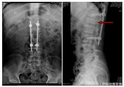 厉害了，这些骨科医生——306医院骨科成功救治非洲务工者